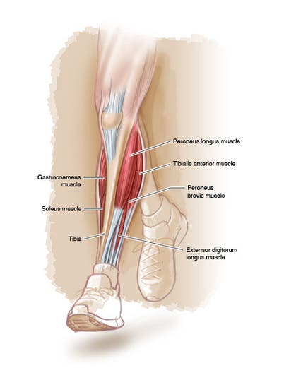 shin splints running