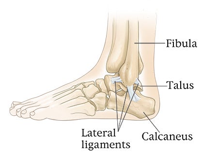 Coping with Ankle Sprains - Trail Runner Magazine