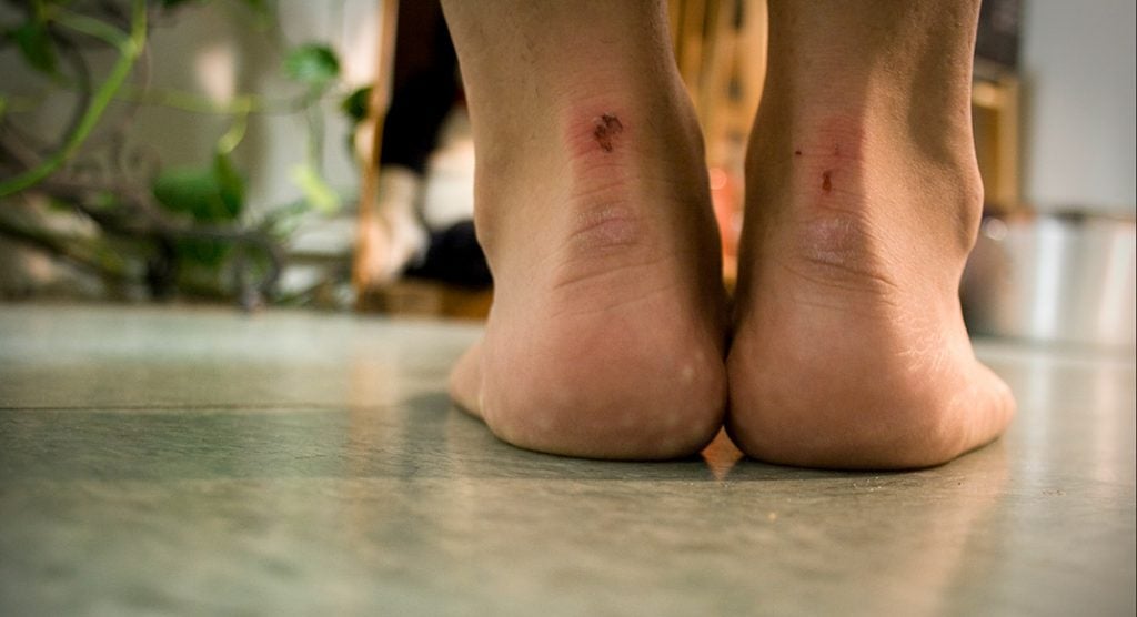 A Runner's Foot Pain Speaks Truth Trail Runner Magazine