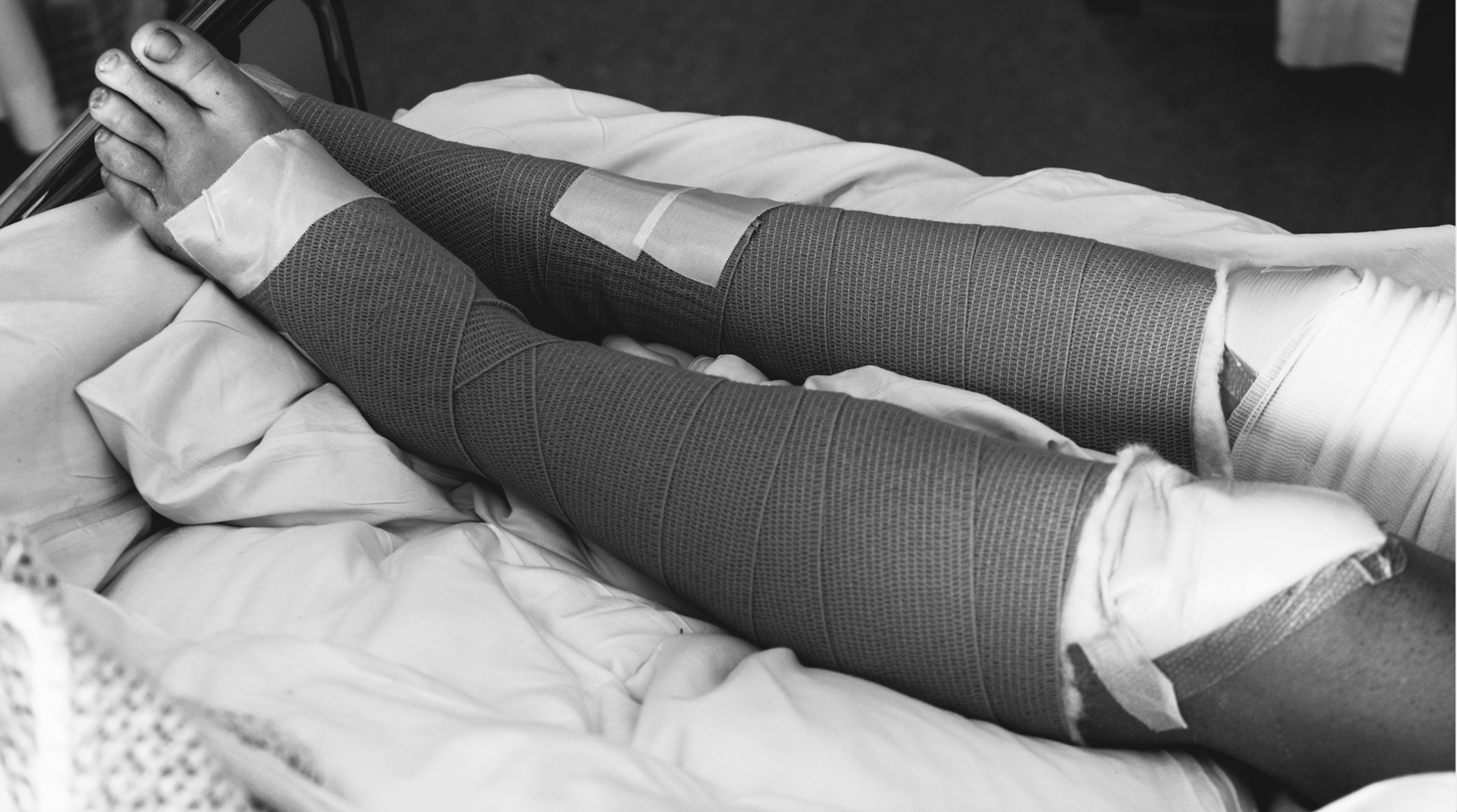 Hillary Allen's injuries