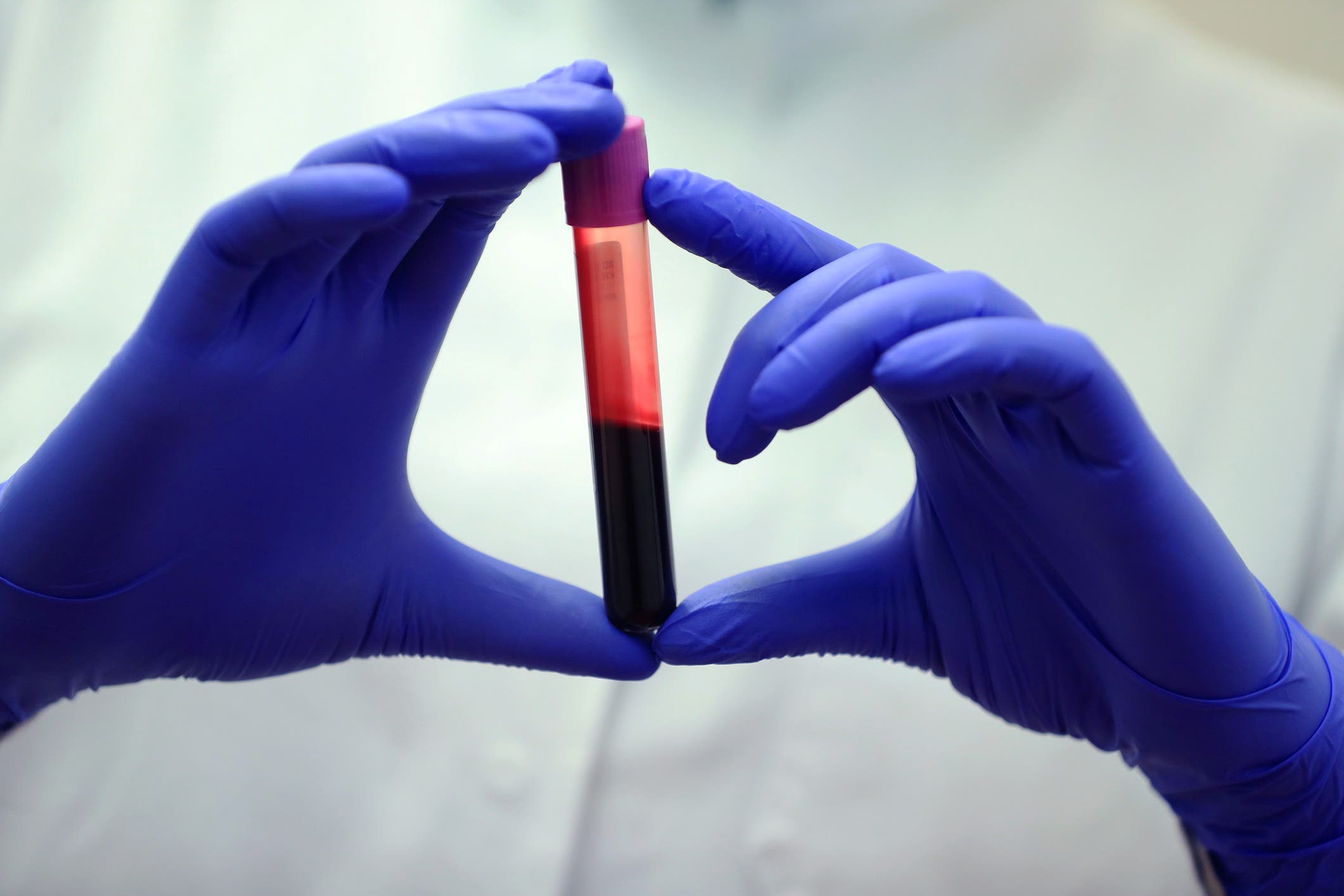 The Science of Hemoglobin Mass and Endurance Performance